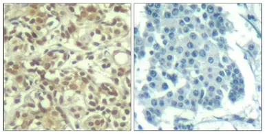 Anti-AKT (phospho Thr450) antibody used in IHC (Paraffin sections) (IHC-P). GTX50339