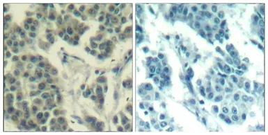 Anti-Her3 / ErbB3 (phospho Tyr1328) antibody used in IHC (Paraffin sections) (IHC-P). GTX50341