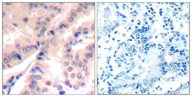 Anti-eIF4B (phospho Ser422) antibody used in IHC (Paraffin sections) (IHC-P). GTX50343