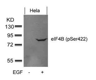 Anti-eIF4B (phospho Ser422) antibody used in Western Blot (WB). GTX50343