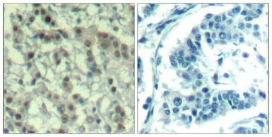 Anti-Aurora A (phospho Thr288) antibody used in IHC (Paraffin sections) (IHC-P). GTX50345