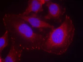 Anti-PLCG1 (phospho Tyr771) antibody used in Immunocytochemistry/ Immunofluorescence (ICC/IF). GTX50346