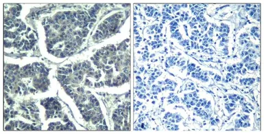 Anti-PLCG2 (phospho Tyr1217) antibody used in IHC (Paraffin sections) (IHC-P). GTX50347
