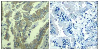 Anti-MARCKS (phospho Ser170) antibody used in IHC (Paraffin sections) (IHC-P). GTX50348