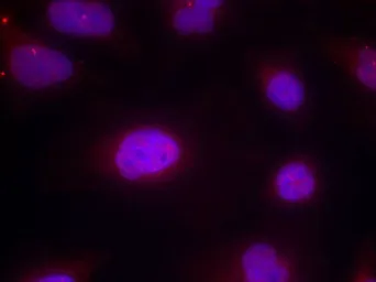 Anti-Cyclin B1 (Phospho Ser147) antibody used in Immunocytochemistry/ Immunofluorescence (ICC/IF). GTX50351