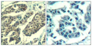 Anti-Cyclin B1 (Phospho Ser147) antibody used in IHC (Paraffin sections) (IHC-P). GTX50351