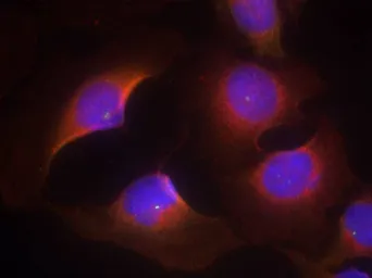 Anti-CDK6 (Phospho Tyr13) antibody used in Immunocytochemistry/ Immunofluorescence (ICC/IF). GTX50352