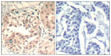 Anti-CDK6 (Phospho Tyr13) antibody used in IHC (Paraffin sections) (IHC-P). GTX50352