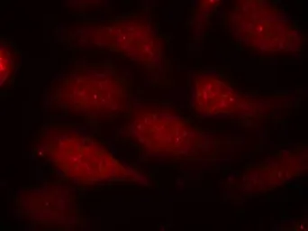 Anti-CDK6 (Phospho Tyr24) antibody used in Immunocytochemistry/ Immunofluorescence (ICC/IF). GTX50353