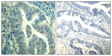 Anti-CDK6 (Phospho Tyr24) antibody used in IHC (Paraffin sections) (IHC-P). GTX50353
