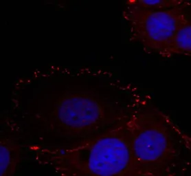Anti-FAK (phospho Tyr576/577) antibody used in Immunocytochemistry/ Immunofluorescence (ICC/IF). GTX50354