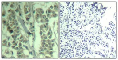 Anti-CBL (phospho Tyr700) antibody used in IHC (Paraffin sections) (IHC-P). GTX50356