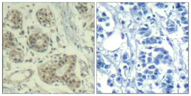 Anti-MDM2 (phospho Ser166) antibody used in IHC (Paraffin sections) (IHC-P). GTX50357