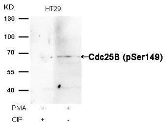 Anti-CDC25B (phospho Ser149) antibody used in Western Blot (WB). GTX50360