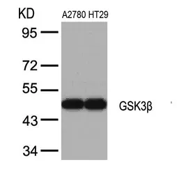 Anti-GSK3 beta antibody used in Western Blot (WB). GTX50363