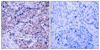 Anti-PDPK1 / PDK1 antibody used in IHC (Paraffin sections) (IHC-P). GTX50366