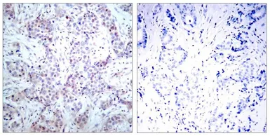 Anti-NFkB p65 antibody used in IHC (Paraffin sections) (IHC-P). GTX50374