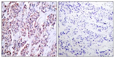 Anti-NFkB p100 antibody used in IHC (Paraffin sections) (IHC-P). GTX50376