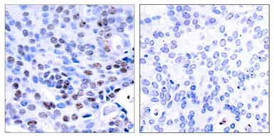 Anti-NFkB p105/p50 antibody used in IHC (Paraffin sections) (IHC-P). GTX50377