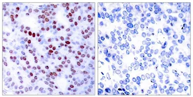 Anti-c-Jun antibody used in IHC (Paraffin sections) (IHC-P). GTX50385