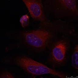 Anti-JunB antibody used in Immunocytochemistry/ Immunofluorescence (ICC/IF). GTX50386
