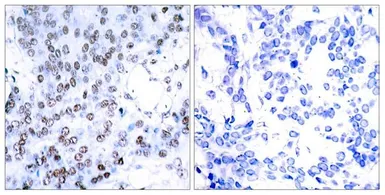 Anti-JunB antibody used in IHC (Paraffin sections) (IHC-P). GTX50386