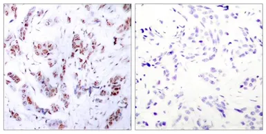Anti-MEF2A antibody used in IHC (Paraffin sections) (IHC-P). GTX50397
