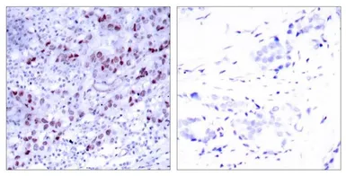Anti-GATA1 antibody used in IHC (Paraffin sections) (IHC-P). GTX50399
