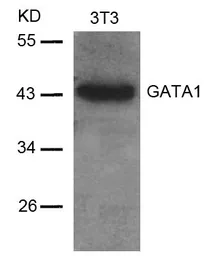 Anti-GATA1 antibody used in Western Blot (WB). GTX50399