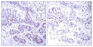 Anti-STAT4 antibody used in IHC (Paraffin sections) (IHC-P). GTX50403