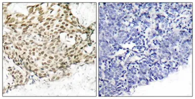 Anti-NBS1 antibody used in IHC (Paraffin sections) (IHC-P). GTX50412