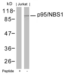 Anti-NBS1 antibody used in Western Blot (WB). GTX50412