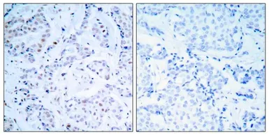 Anti-Estrogen Receptor alpha antibody used in IHC (Paraffin sections) (IHC-P). GTX50418