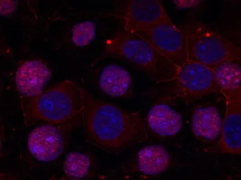 Anti-Estrogen Receptor alpha antibody used in Immunocytochemistry/ Immunofluorescence (ICC/IF). GTX50421
