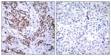 Anti-Estrogen Receptor alpha antibody used in IHC (Paraffin sections) (IHC-P). GTX50421