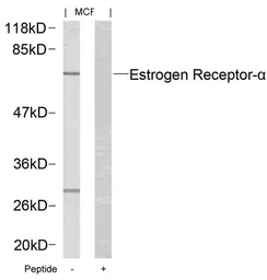 Anti-Estrogen Receptor alpha antibody used in Western Blot (WB). GTX50421