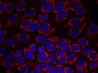 Anti-Her2 / ErbB2 antibody used in Immunocytochemistry/ Immunofluorescence (ICC/IF). GTX50425