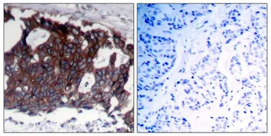 Anti-Her2 / ErbB2 antibody used in IHC (Paraffin sections) (IHC-P). GTX50425