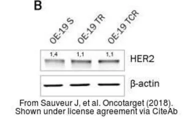 Anti-Her2 / ErbB2 antibody used in Western Blot (WB). GTX50425
