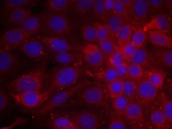 Anti-EGFR antibody used in Immunocytochemistry/ Immunofluorescence (ICC/IF). GTX50426