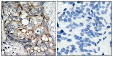 Anti-EGFR antibody used in IHC (Paraffin sections) (IHC-P). GTX50426