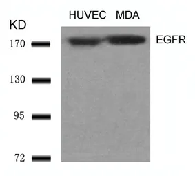Anti-EGFR antibody used in Western Blot (WB). GTX50426
