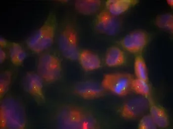 Anti-Tau antibody used in Immunocytochemistry/ Immunofluorescence (ICC/IF). GTX50444