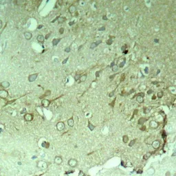 Anti-Tau antibody used in IHC (Paraffin sections) (IHC-P). GTX50445
