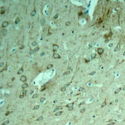 Anti-Tau antibody used in IHC (Paraffin sections) (IHC-P). GTX50451
