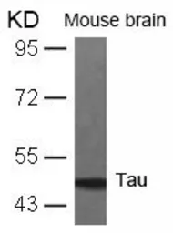 Anti-Tau antibody used in Western Blot (WB). GTX50451