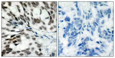 Anti-Rb antibody used in IHC (Paraffin sections) (IHC-P). GTX50460