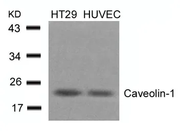 Anti-Caveolin 1 antibody used in Western Blot (WB). GTX50462