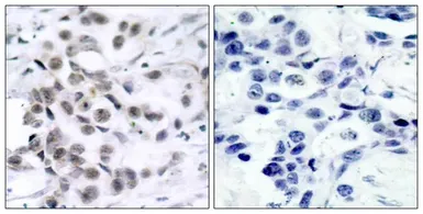 Anti-Chk1 antibody used in IHC (Paraffin sections) (IHC-P). GTX50463