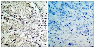 Anti-MEK3 antibody used in IHC (Paraffin sections) (IHC-P). GTX50464
